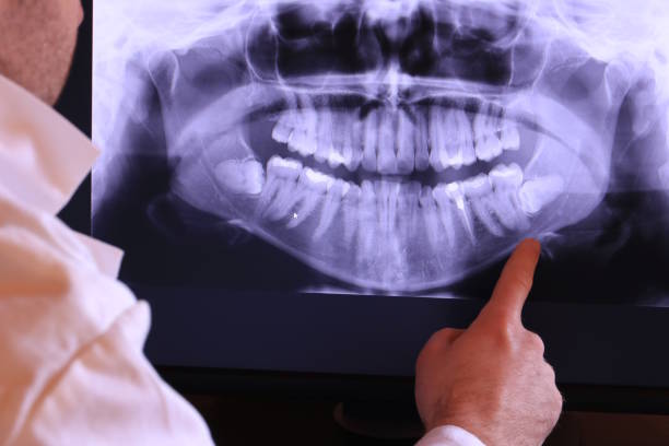 Best Emergency Dental Extractions in Woodsboro, TX